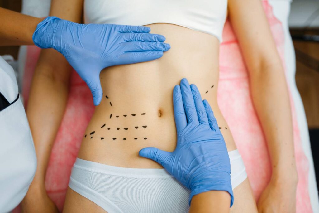 Guía de cuidados esenciales para la recuperación postoperatoria 4 Ultra definicion abdominal