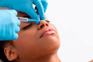 Consejos para una Recuperación Efectiva Después de la Rinoplastia 2 Rinoplastia