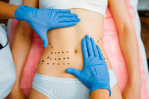 Ultra definición abdominal