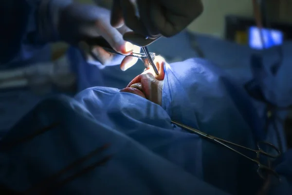Consejos para una Recuperación Efectiva Después de la Rinoplastia 3 cirugano rinoplastia