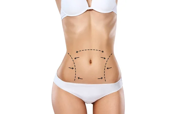 Descubre los beneficios más importantes de la liposucción y cómo puede mejorar tu vida 5 liposuccion 1