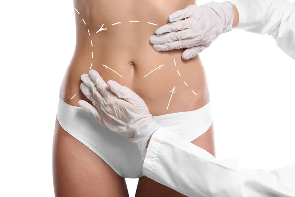 Descubre los beneficios más importantes de la liposucción y cómo puede mejorar tu vida 2 operacion plastica