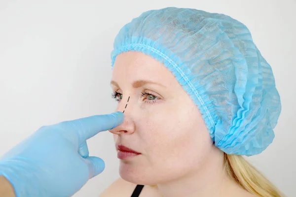 Consejos para una Recuperación Efectiva Después de la Rinoplastia 5 rhinoplasty