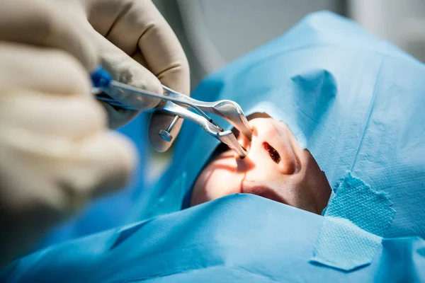 ala nasal rinoplastia