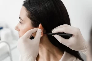la otoplastia