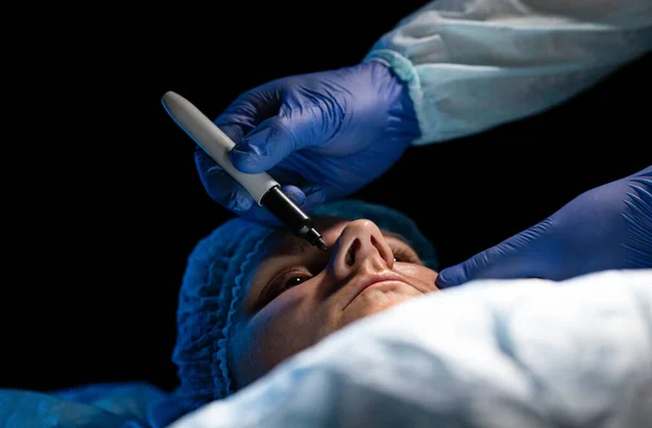 rinoplastia ala nasal