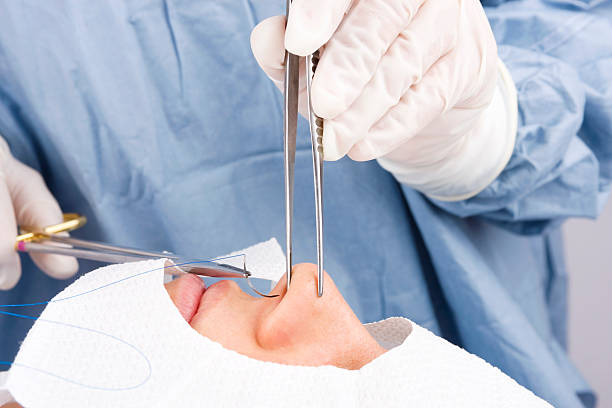 rinoplastia alas nasales